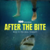 After the Bite